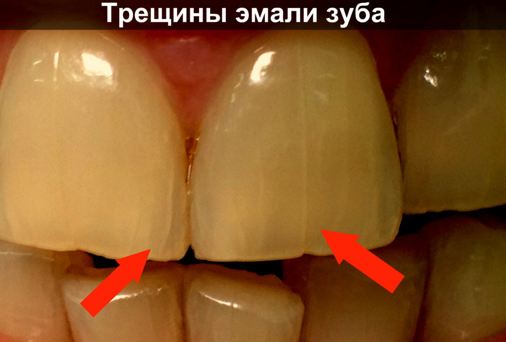 Как сшить новогодний костюм "петуха"? Как сделать волосы прямыми как сделать прямые волосы Прически