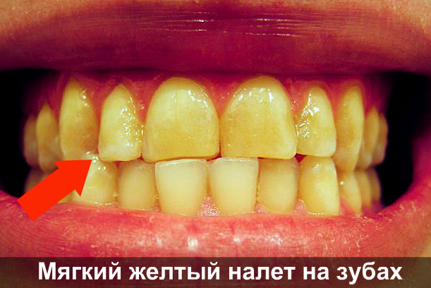 Фасад дома короед своими руками Фасад дома короед своими руками