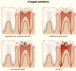 легкая боль в зубе фото