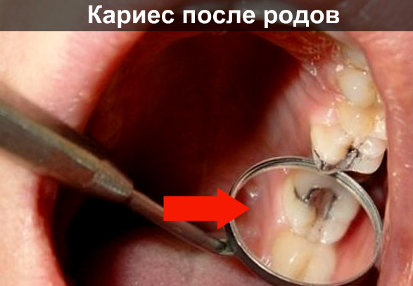 Сводит зубы после кормления