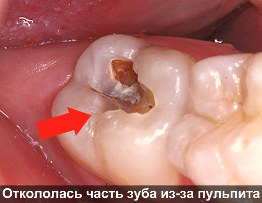 Болит голова зуб когда ложишься