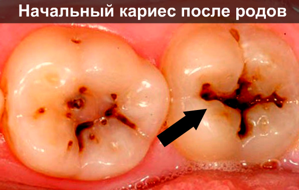 Сводит зубы после кормления