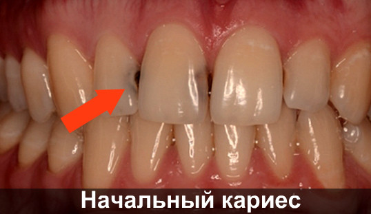 Сводит зубы после кормления