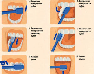 Активная гигиена полости рта способна убрать коричневый налет с зубов