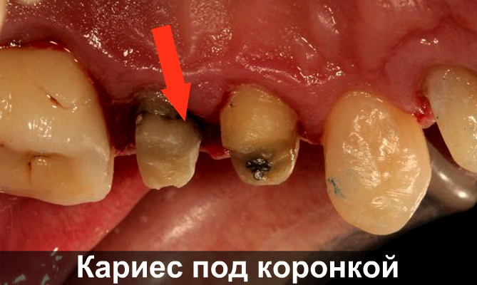Зуб дергает и очень болит Зуб дергает и очень болит thumbnail