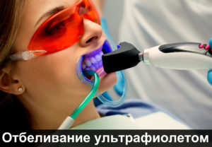 Отбеливание зубов ультрафиолетом