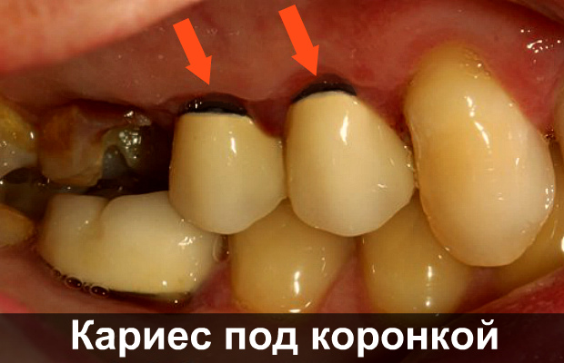 Зуб дергает и очень болит
