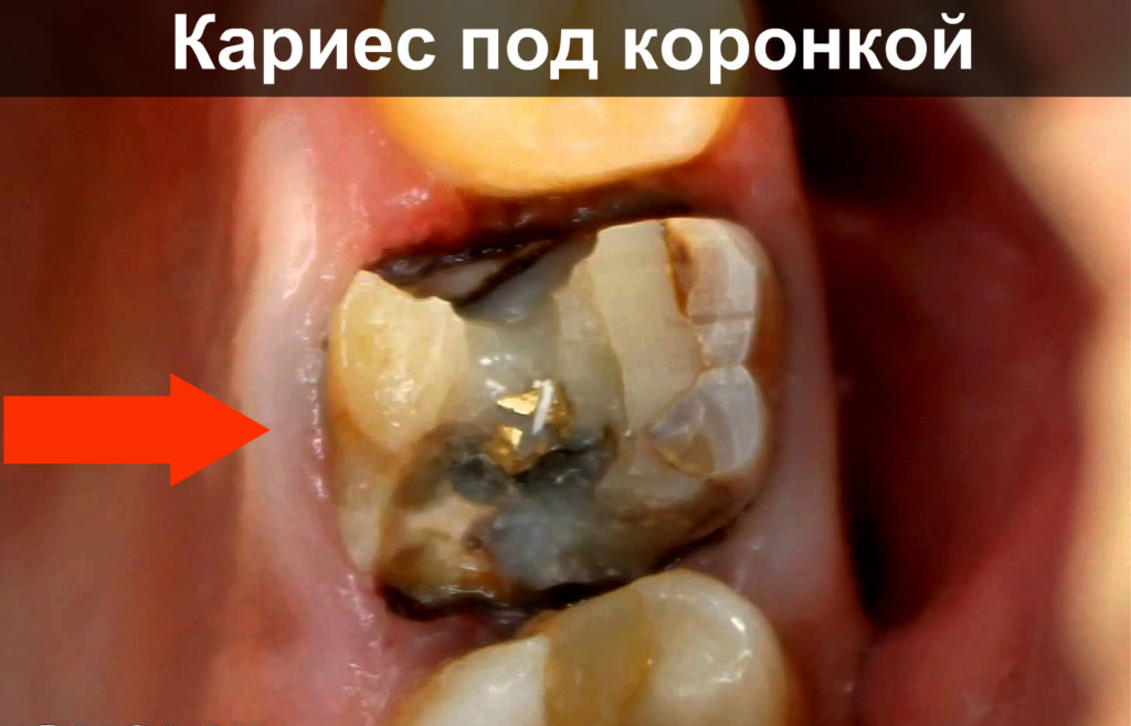 Зуб дергает и очень болит