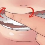 левомеколь для десен фото