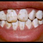 Бальзам для десен асепта