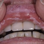 актив гель лесной бальзам самовосстановление