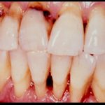 бальзам асепта при беременности