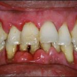 гель ополаскиватель лесной бальзам