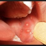 холисал стоматологический