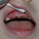 камистад гель отзывы