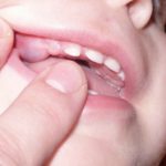 камистад гель применение