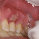 лесной бальзам гель для десен