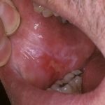 лесной бальзам ополаскиватель актив гель