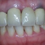 почему синеют десна