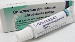 Солкосерил гель — эффективное средство для лечения десен