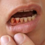 кровоточат десна и неприятный запах