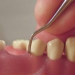 провалилась десна