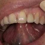 пульсирует десна