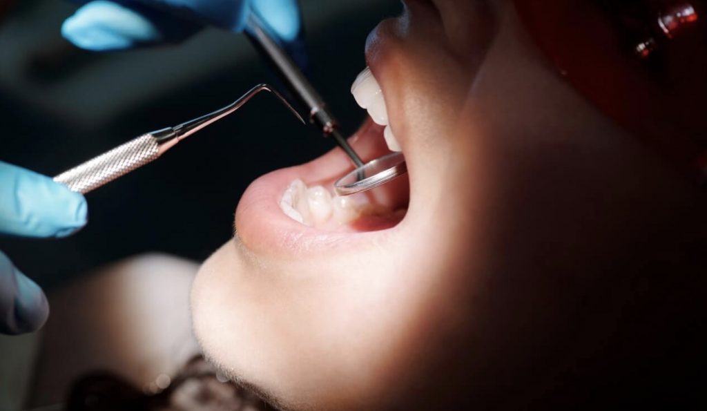 удаление зуба в стоматологии